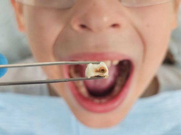 Best Pediatric Emergency Dentist in Gates Mills, OH